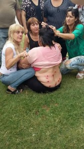 represión La Plata mujer herida