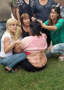 represión La Plata mujer herida